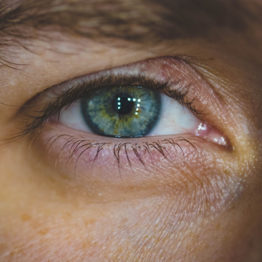 eyeball macular degeneration