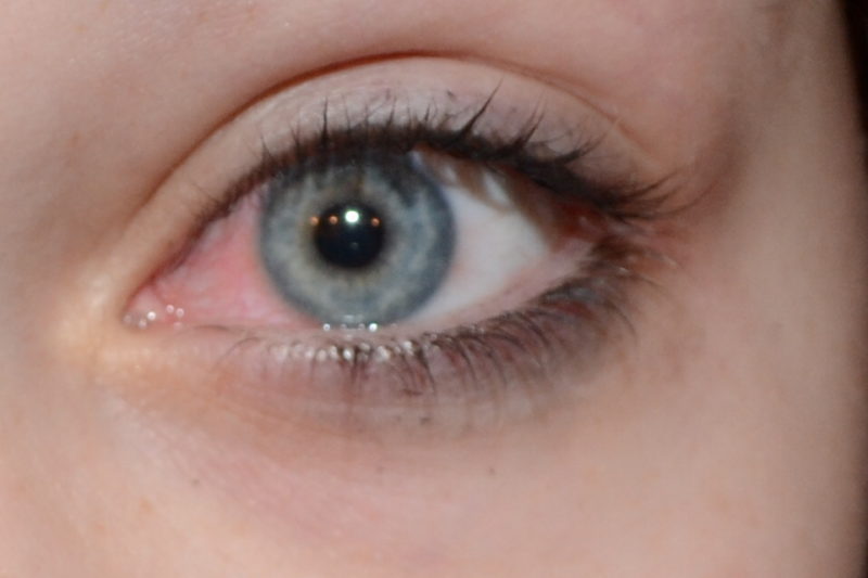 Do Contact Lenses Have an Expiration Date