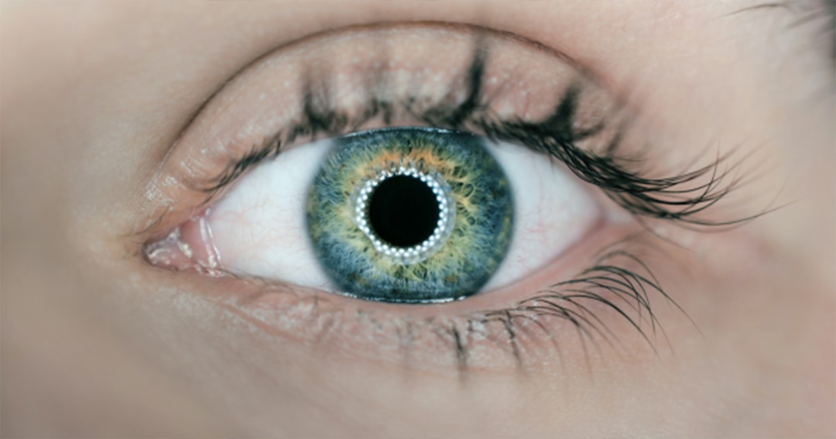 Recognizing And Treating Ocular Allergies