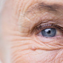 Eye of a senior citizen, up close.