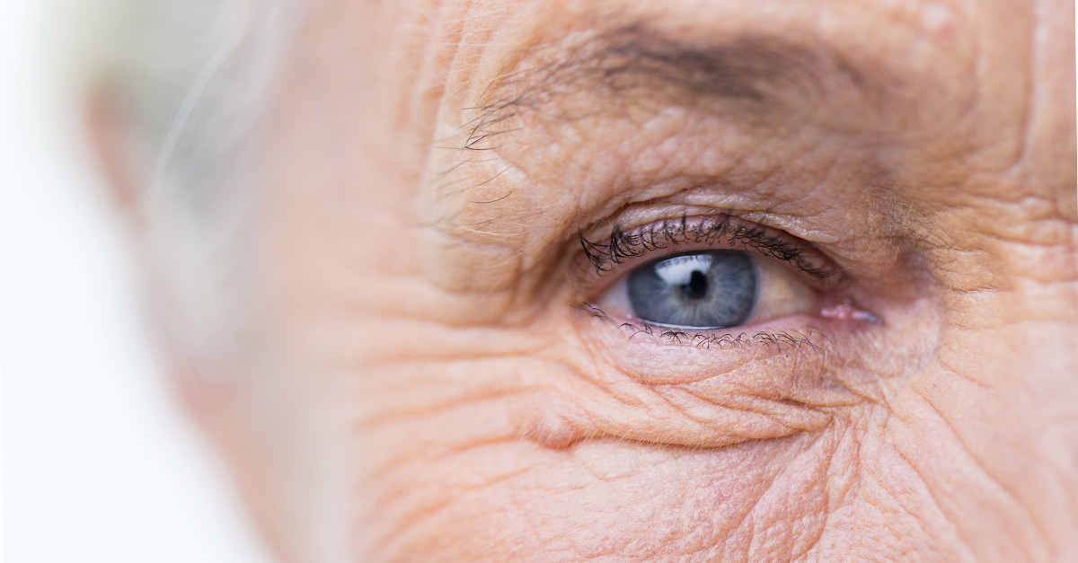 Eye of a senior citizen, up close.
