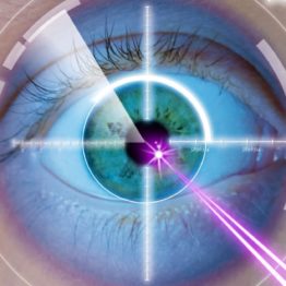 eye laser correction